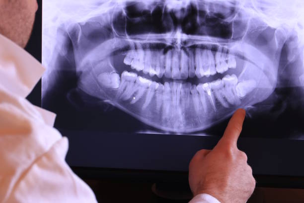 Best Urgent Care for Lost Fillings or Crowns in Murfreesboro, AR