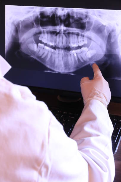 Best Emergency Treatment for Dental Infections or Abscesses in Murfreesboro, AR